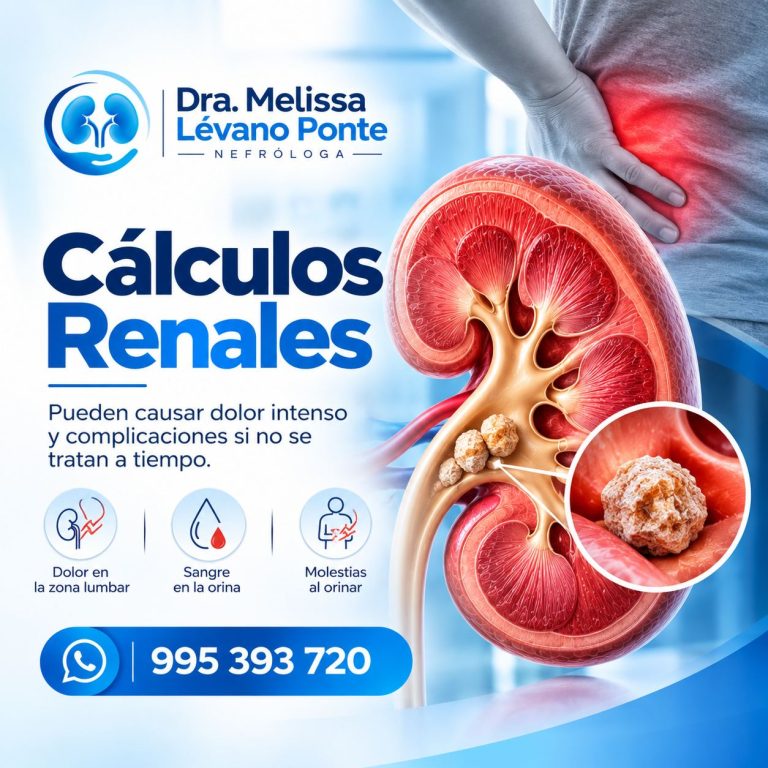 Cálculos renales_ síntomas y tratamiento