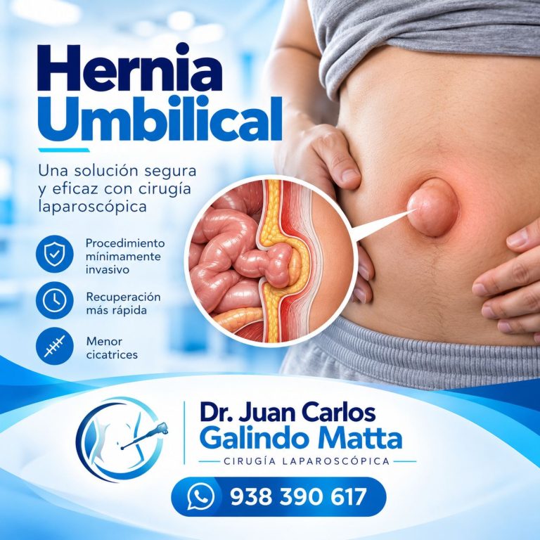 Hernia umbilical_ cirugía laparoscópica segura